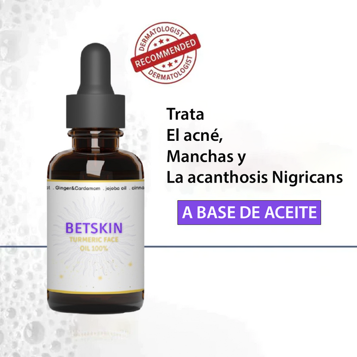 (LLEVA 2x1)🎁 GINGER OIL™ ACNÉ + MANCHAS + ACANTOSIS NIGRICANS