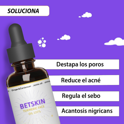 (LLEVA 2x1)🎁 GINGER OIL™ ACNÉ + MANCHAS + ACANTOSIS NIGRICANS