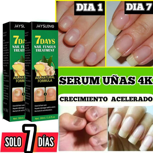 600% 🎁Base Uñas 4K + Potente🙅‍♀️ + Crecimiento & Hongos AVANZADO